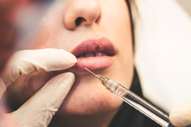 How often should I get dermal fillers?